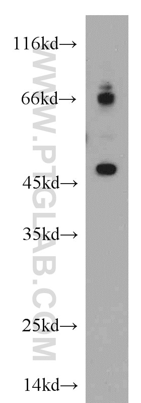 Western Blot (WB) analysis of MCF-7 cells using ELK4 Polyclonal antibody (14666-1-AP)