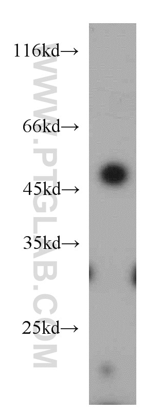 Western Blot (WB) analysis of HeLa cells using ELK4 Polyclonal antibody (14666-1-AP)