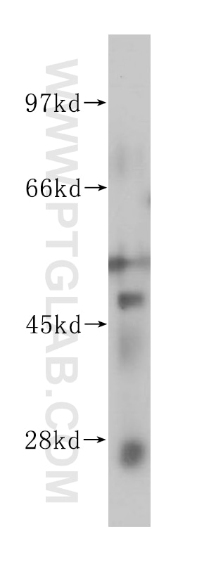 Western Blot (WB) analysis of MCF-7 cells using ELK4 Polyclonal antibody (14666-1-AP)