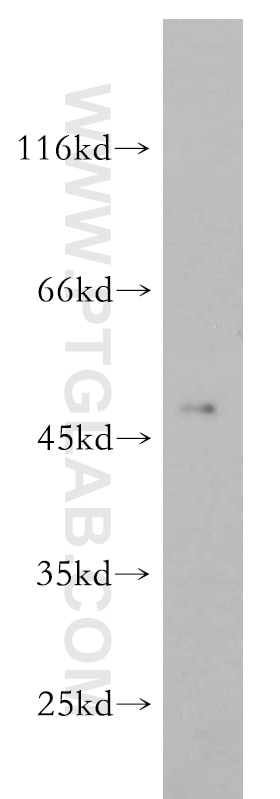 Western Blot (WB) analysis of HeLa cells using ELK4 Polyclonal antibody (14666-1-AP)