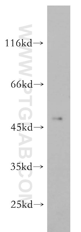 WB analysis of HeLa using 14666-1-AP