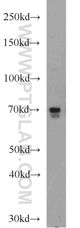 WB analysis of HeLa using 51044-1-AP