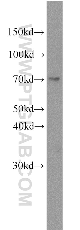 Western Blot (WB) analysis of HL-60 cells using ELL Polyclonal antibody (51044-1-AP)