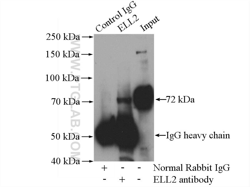 Immunoprecipitation (IP) experiment of mouse brain tissue using ELL2 Polyclonal antibody (12727-1-AP)
