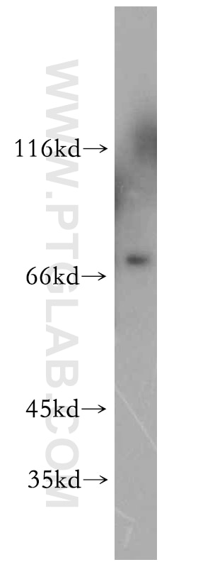 Western Blot (WB) analysis of mouse stomach tissue using ELL2 Polyclonal antibody (12727-1-AP)