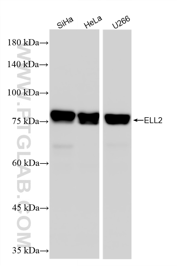 WB analysis using 84226-4-RR (same clone as 84226-4-PBS) Western Blot (WB) analysis of various lysates using ELL2 Recombinant monoclonal antibody (84226-4-RR)
