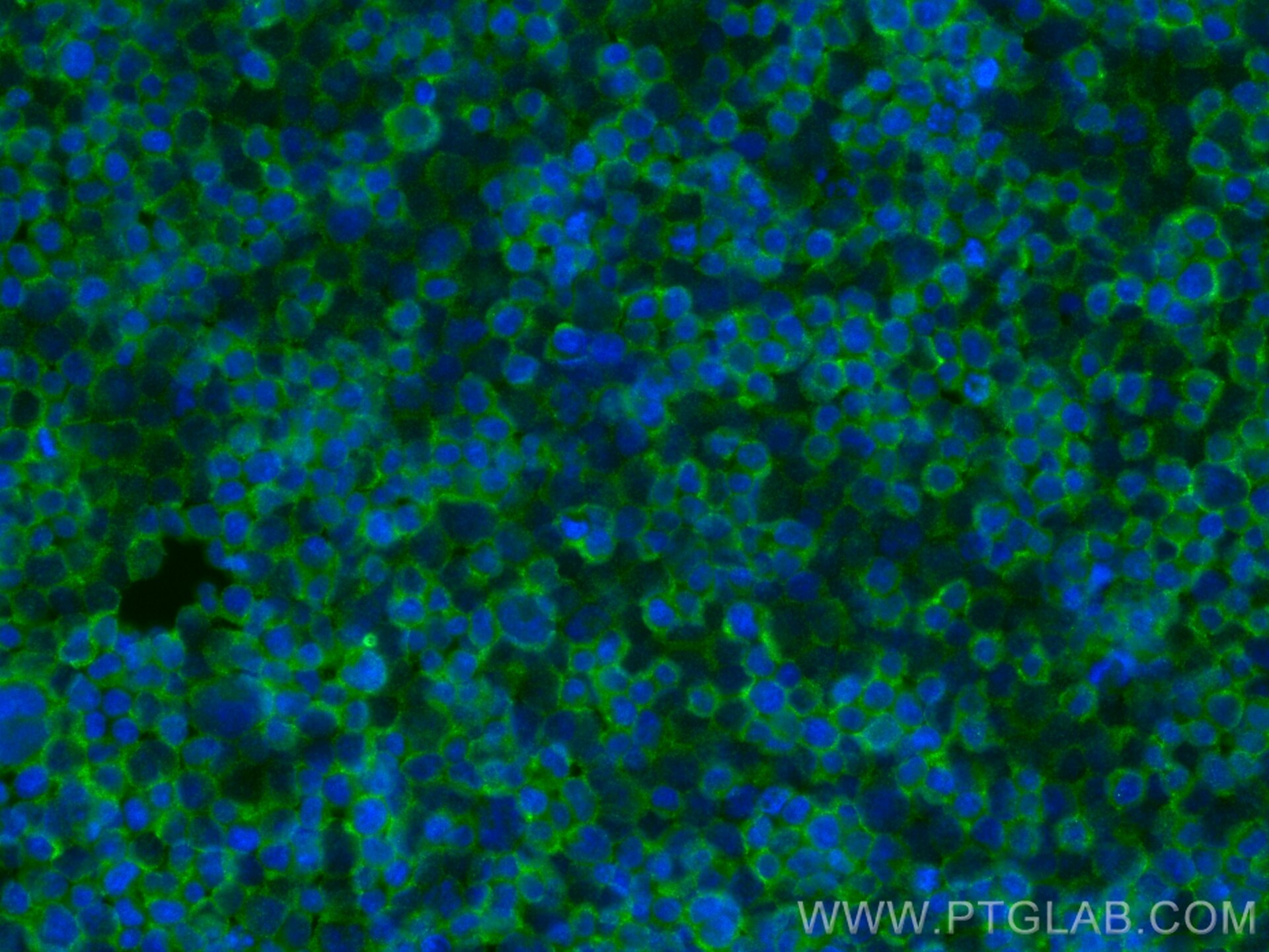 Immunofluorescence (IF) / fluorescent staining of Jurkat cells using ELMO1 Polyclonal antibody (26974-1-AP)