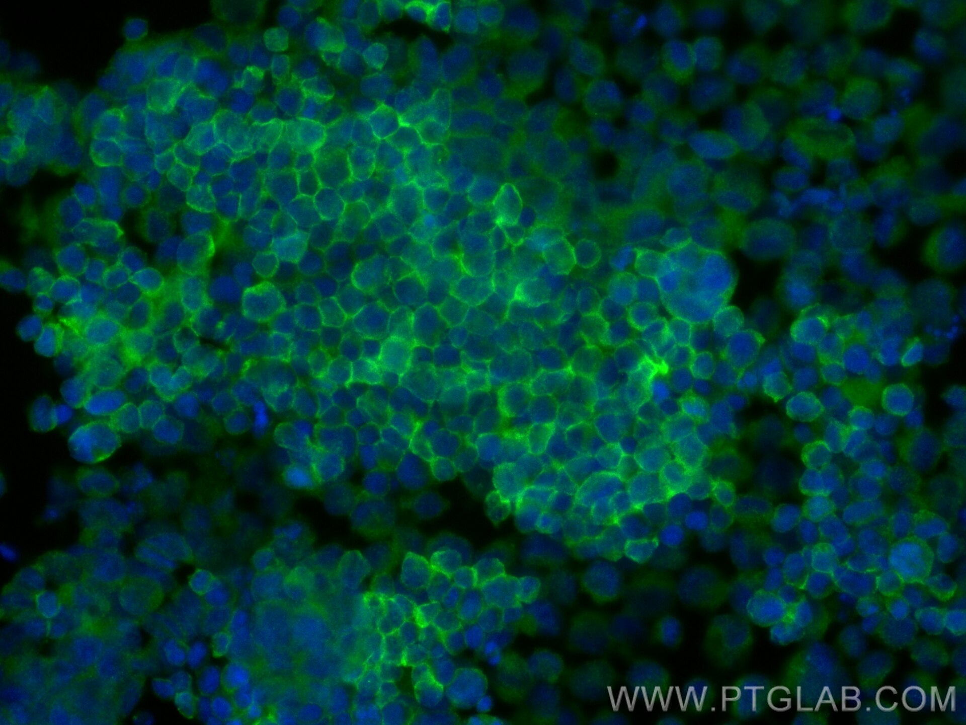 Immunofluorescence (IF) / fluorescent staining of K-562 cells using ELMO1 Polyclonal antibody (26974-1-AP)