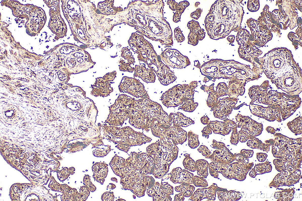 Immunohistochemistry (IHC) staining of human placenta tissue using ELMO1 Polyclonal antibody (26974-1-AP)