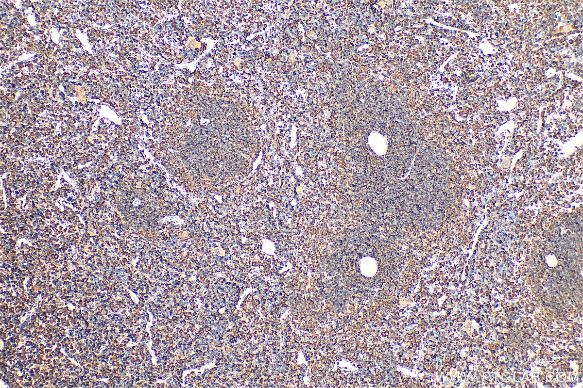 Immunohistochemistry (IHC) staining of mouse spleen tissue using ELMO1 Polyclonal antibody (26974-1-AP)