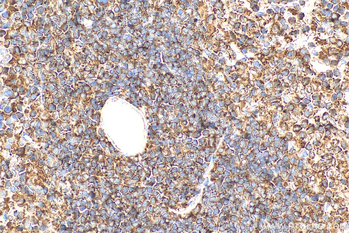 Immunohistochemistry (IHC) staining of mouse spleen tissue using ELMO1 Polyclonal antibody (26974-1-AP)