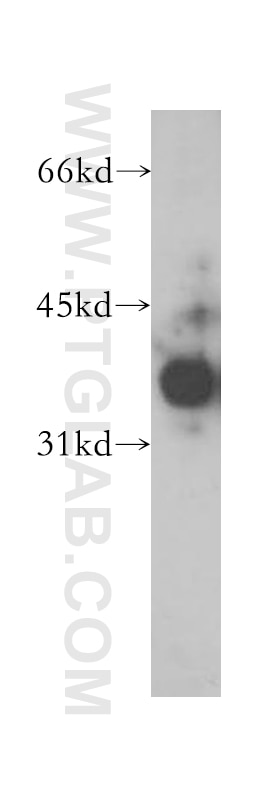 Western Blot (WB) analysis of human brain tissue using ELMOD1 Polyclonal antibody (12761-1-AP)