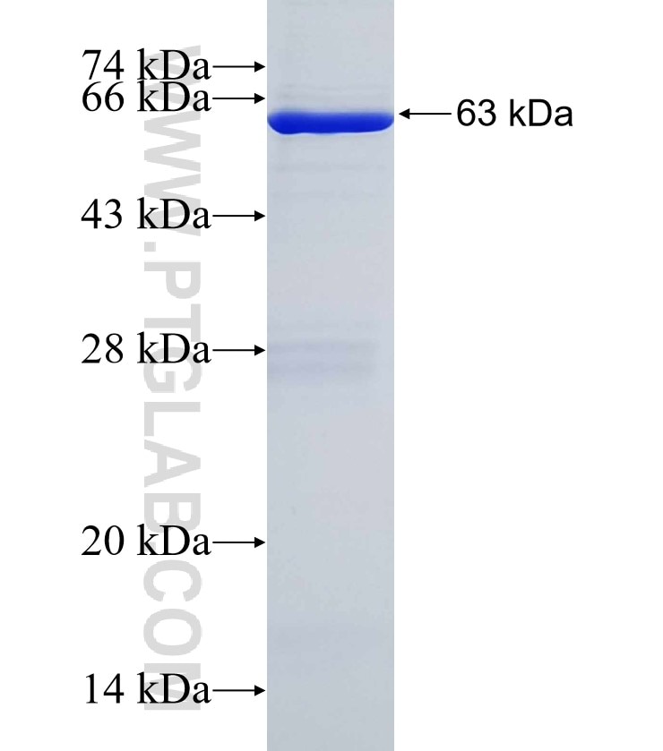 ELMOD1 fusion protein Ag3368 SDS-PAGE