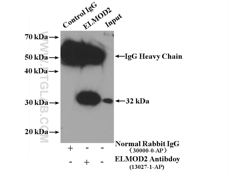 Immunoprecipitation (IP) experiment of A549 cells using ELMOD2 Polyclonal antibody (13027-1-AP)