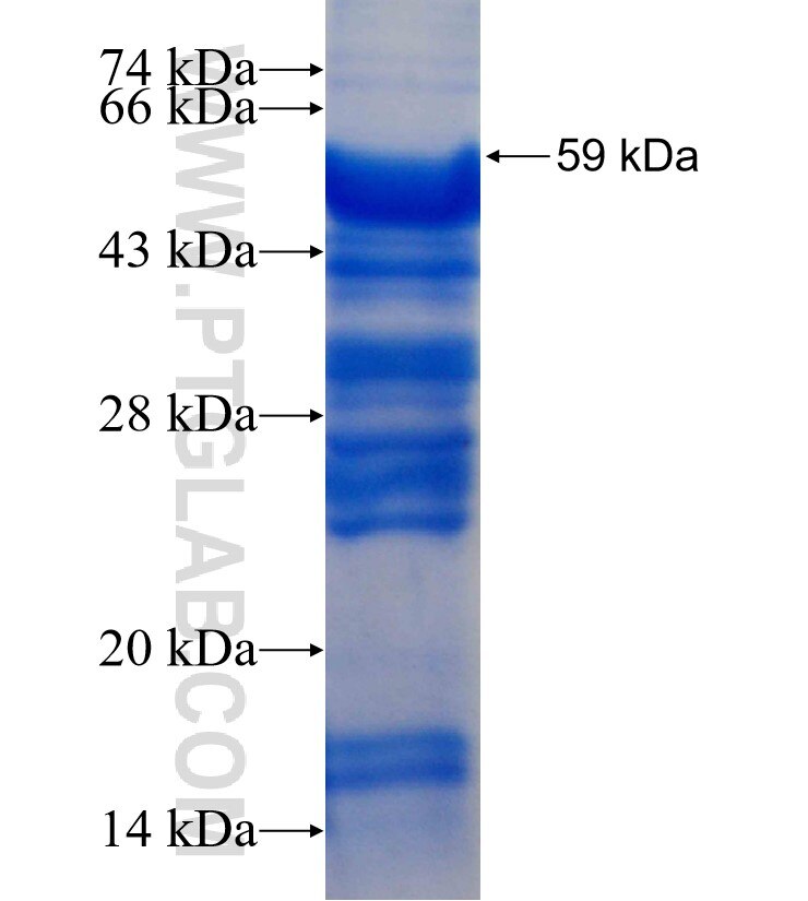 ELMOD2 fusion protein Ag3653 SDS-PAGE