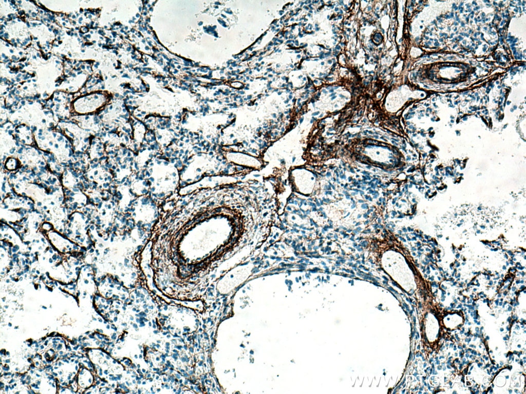 Immunohistochemistry (IHC) staining of human lung tissue using Elastin Polyclonal antibody (15257-1-AP)