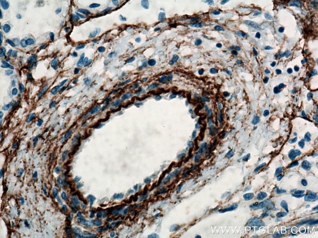 Immunohistochemistry (IHC) staining of human lung tissue using Elastin Polyclonal antibody (15257-1-AP)