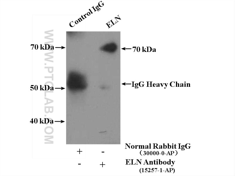 Immunoprecipitation (IP) experiment of human placenta tissue using Elastin Polyclonal antibody (15257-1-AP)