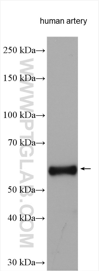 Western Blot (WB) analysis of various lysates using Elastin Polyclonal antibody (15257-1-AP)
