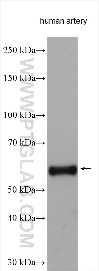 WB analysis using 15257-1-AP