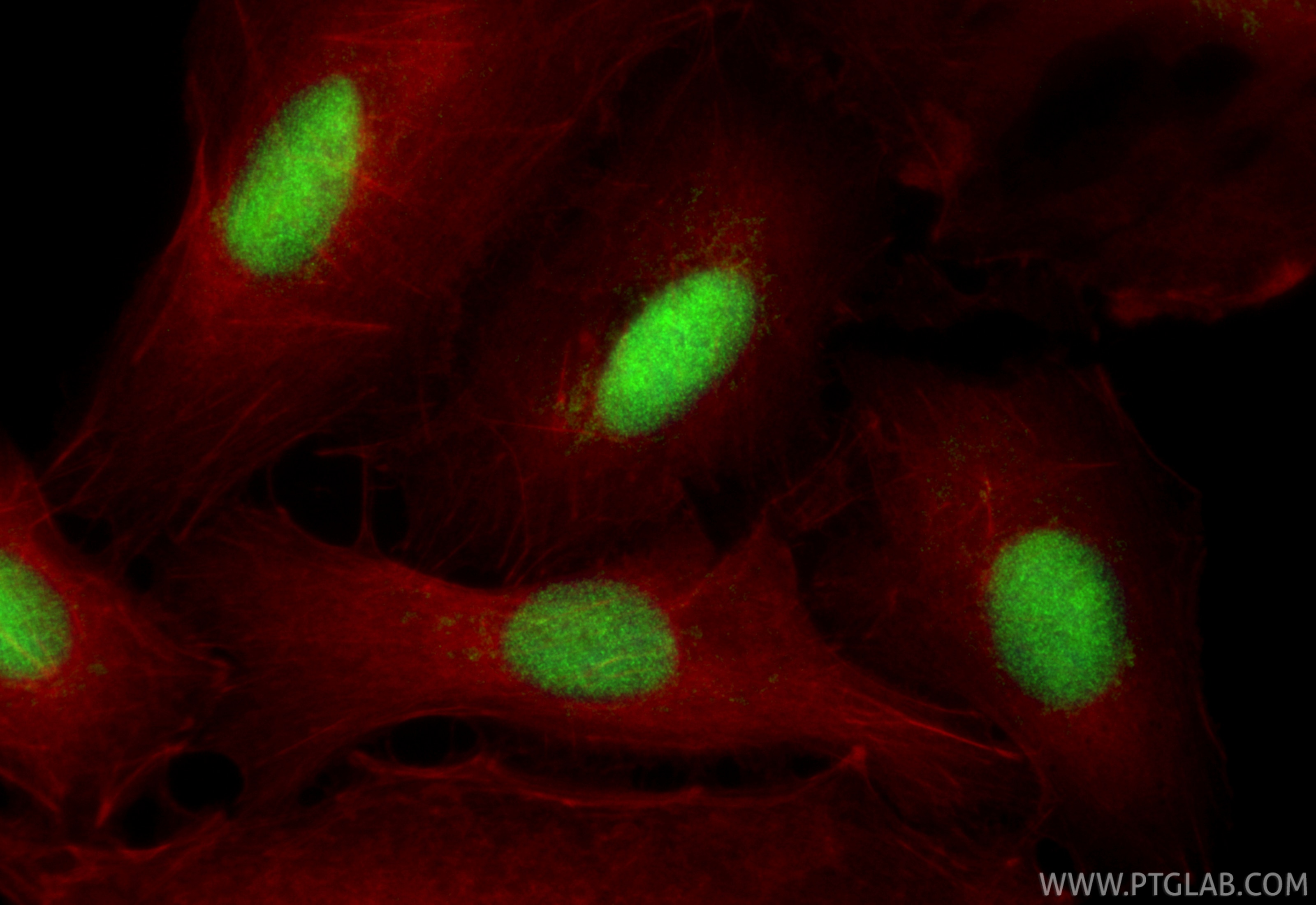 Immunofluorescence (IF) / fluorescent staining of A549 cells using ELOF1 Polyclonal antibody (21070-1-AP)