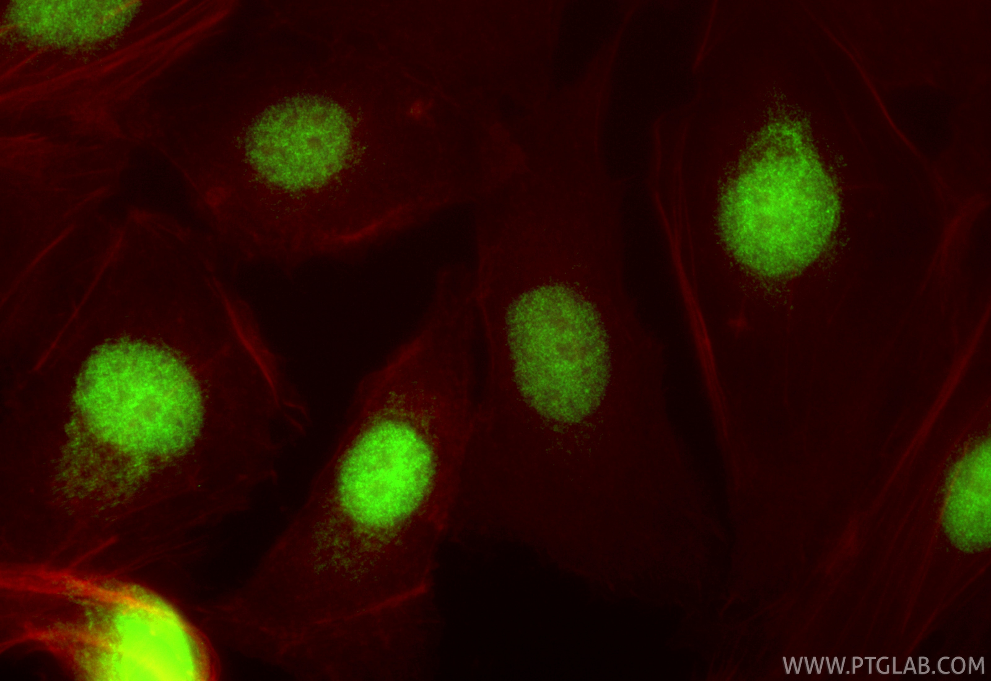Immunofluorescence (IF) / fluorescent staining of SKOV-3 cells using ELOF1 Polyclonal antibody (21070-1-AP)