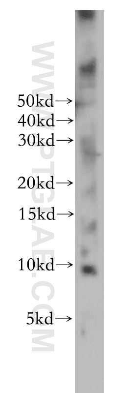Western Blot (WB) analysis of mouse pancreas tissue using ELOF1 Polyclonal antibody (21070-1-AP)