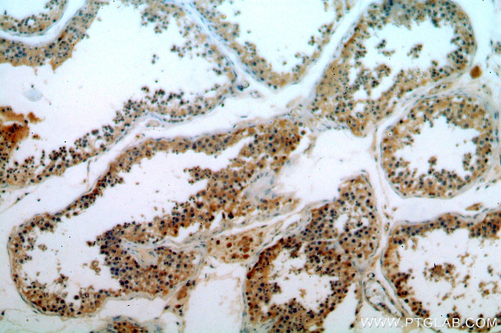 Immunohistochemistry (IHC) staining of human testis tissue using ELOVL2 Polyclonal antibody (20308-1-AP)
