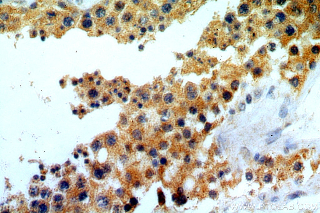 Immunohistochemistry (IHC) staining of human testis tissue using ELOVL2 Polyclonal antibody (20308-1-AP)