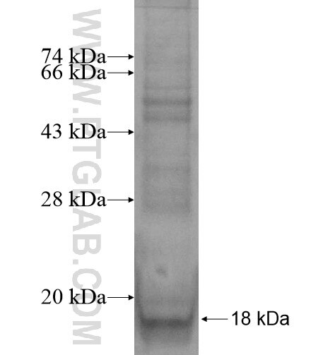 ELOVL2 fusion protein Ag14456 SDS-PAGE