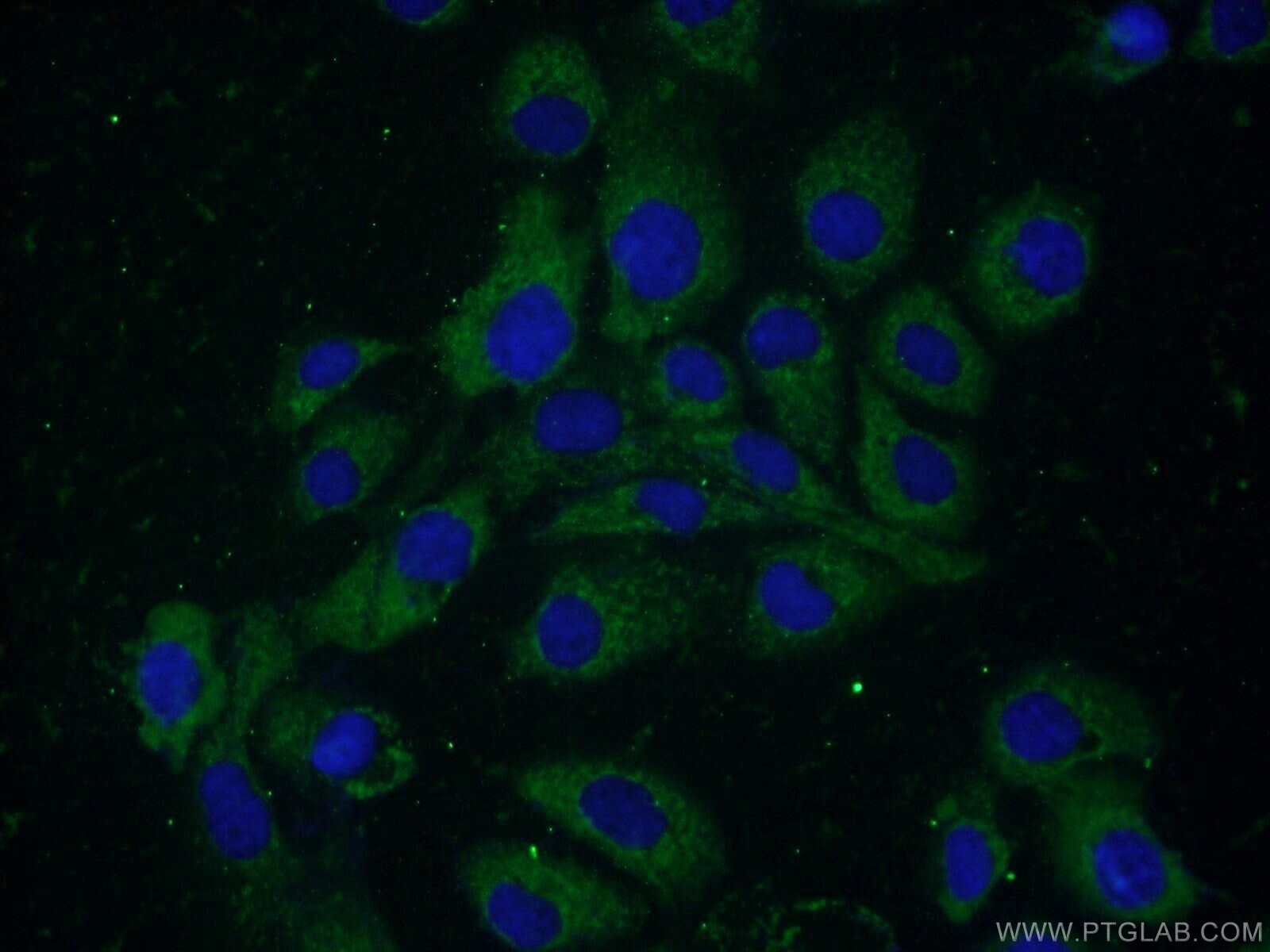 Immunofluorescence (IF) / fluorescent staining of A431 cells using ELOVL4 Polyclonal antibody (55023-1-AP)