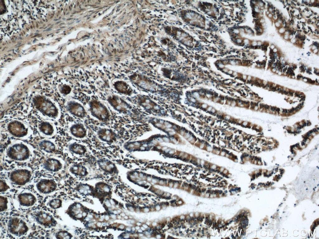 IHC staining of human small intestine using 55023-1-AP