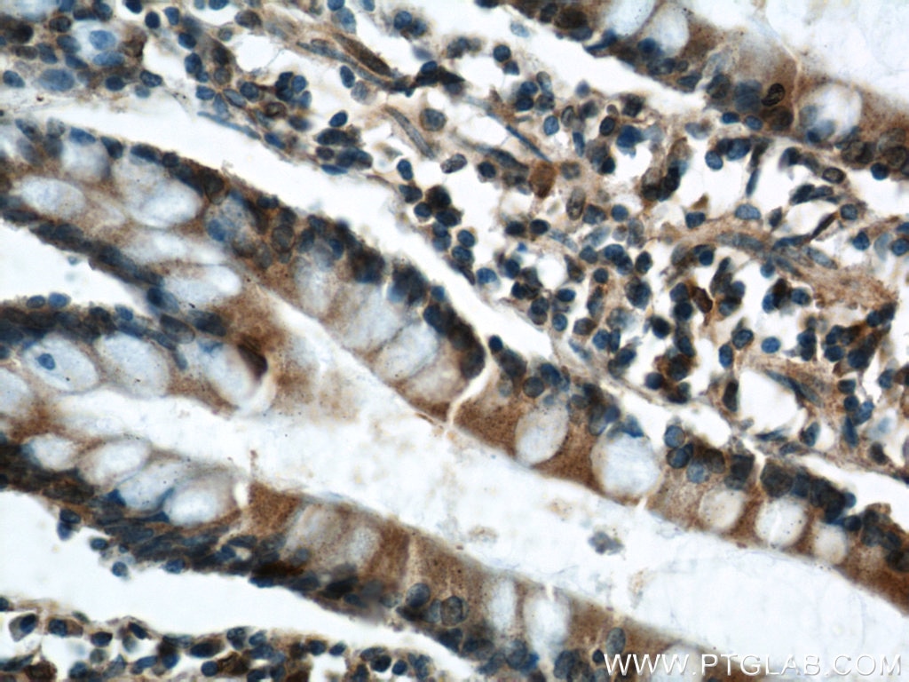 Immunohistochemistry (IHC) staining of human small intestine tissue using ELOVL4 Polyclonal antibody (55023-1-AP)