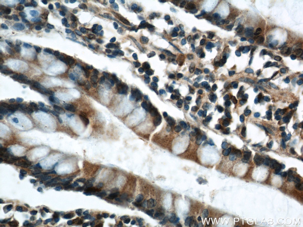 IHC staining of human small intestine using 55023-1-AP