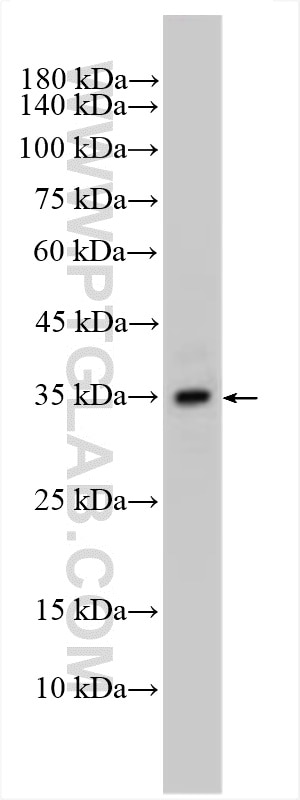 Western Blot (WB) analysis of various lysates using ELOVL4 Polyclonal antibody (55023-1-AP)
