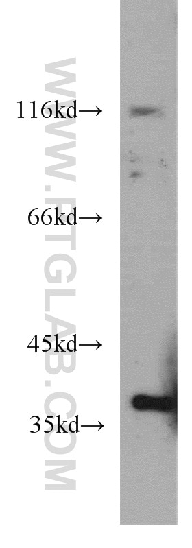Western Blot (WB) analysis of mouse brain tissue using ELOVL4 Polyclonal antibody (55023-1-AP)