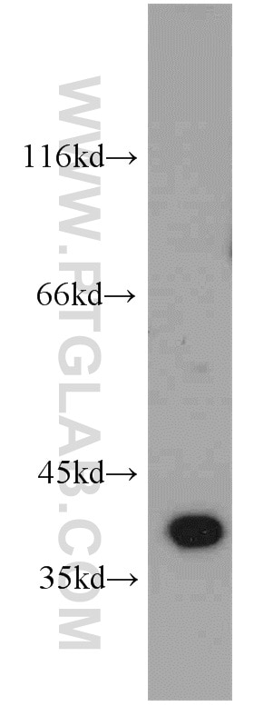 Western Blot (WB) analysis of Y79 cells using ELOVL4 Polyclonal antibody (55023-1-AP)