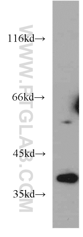 Western Blot (WB) analysis of A431 cells using ELOVL4 Polyclonal antibody (55023-1-AP)