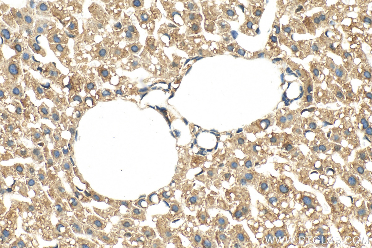 Immunohistochemistry (IHC) staining of mouse liver tissue using ELOVL5 Polyclonal antibody (26599-1-AP)