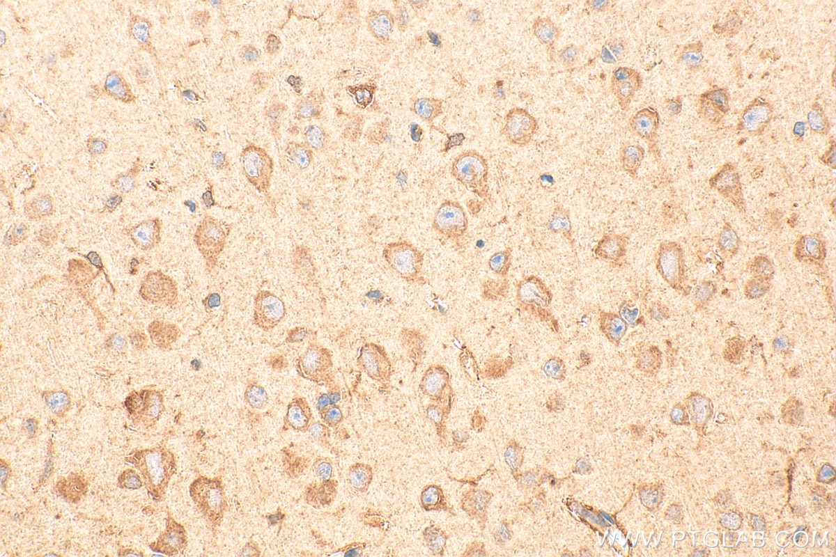 IHC staining of mouse brain using 21160-1-AP Immunohistochemistry (IHC) staining of mouse brain tissue using ELOVL6 Polyclonal antibody (21160-1-AP)