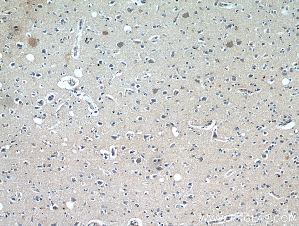 Immunohistochemistry (IHC) staining of human brain tissue using ELOVL6 Polyclonal antibody (21160-1-AP)