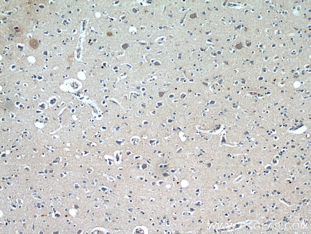 Immunohistochemistry (IHC) staining of human brain tissue using ELOVL6 Polyclonal antibody (21160-1-AP)
