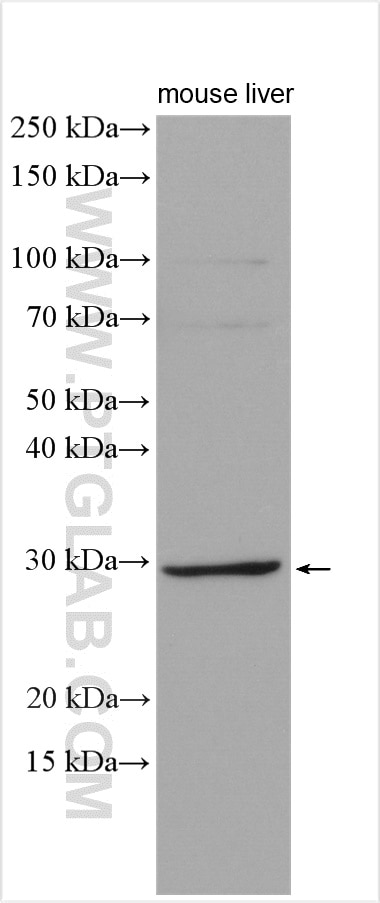 Western Blot (WB) analysis of mouse liver tissue using ELOVL6 Polyclonal antibody (21160-1-AP)