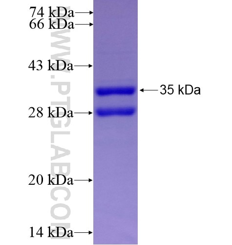 ELOVL6 fusion protein Ag14163 SDS-PAGE