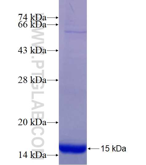 ELOVL6 fusion protein Ag16820 SDS-PAGE