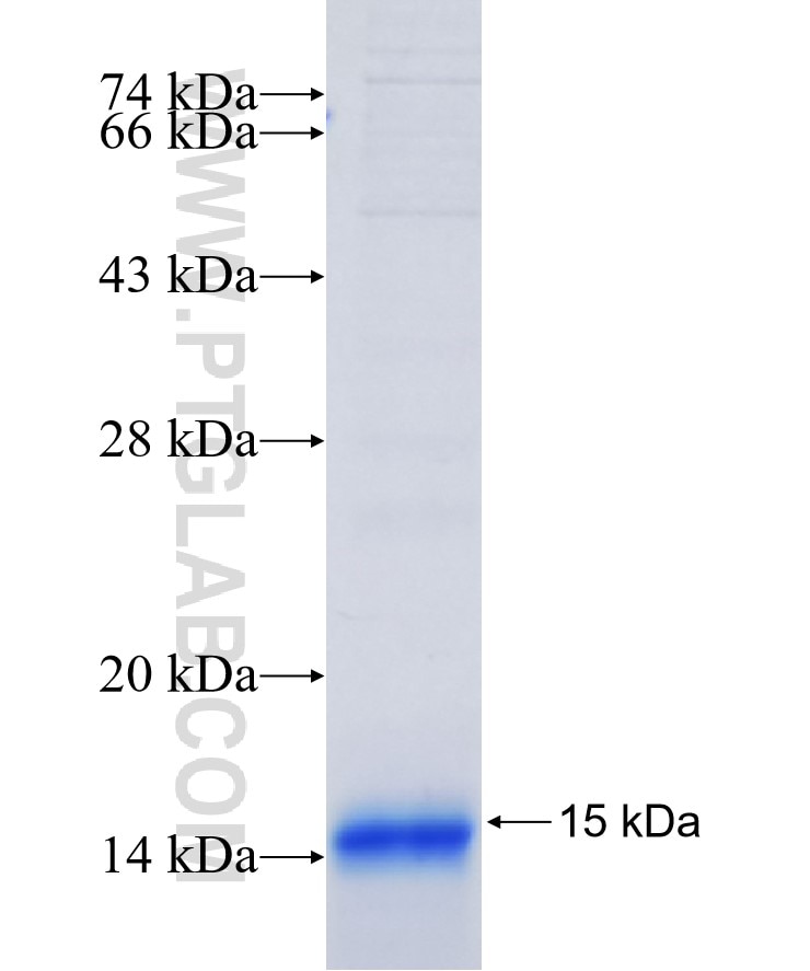 ELOVL6 fusion protein Ag16820 SDS-PAGE