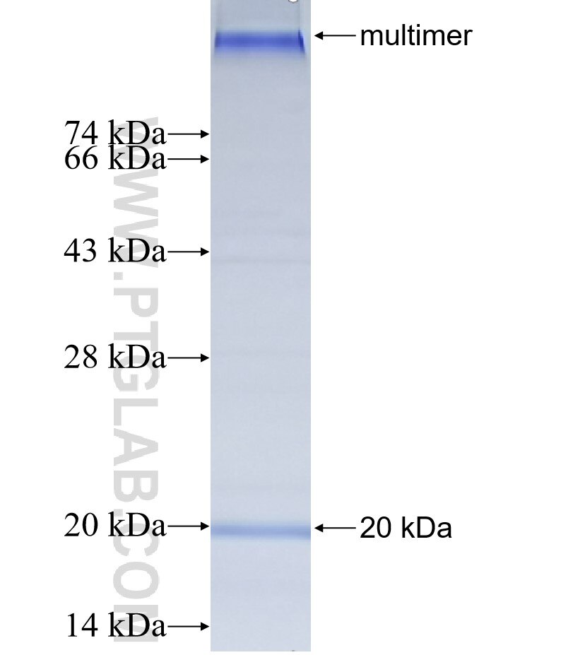 ELOVL7 fusion protein Ag25008 SDS-PAGE