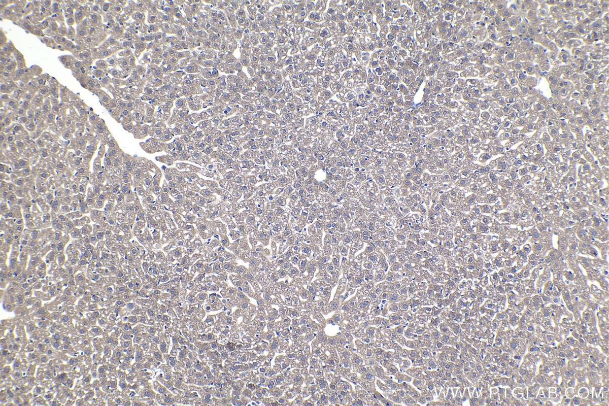 Immunohistochemistry (IHC) staining of mouse liver tissue using ELP2 Polyclonal antibody (13793-1-AP)