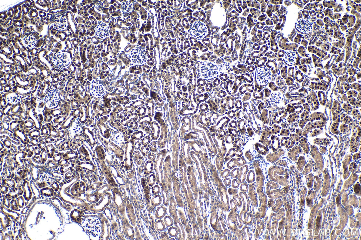 Immunohistochemistry (IHC) staining of mouse kidney tissue using ELP2 Polyclonal antibody (13793-1-AP)