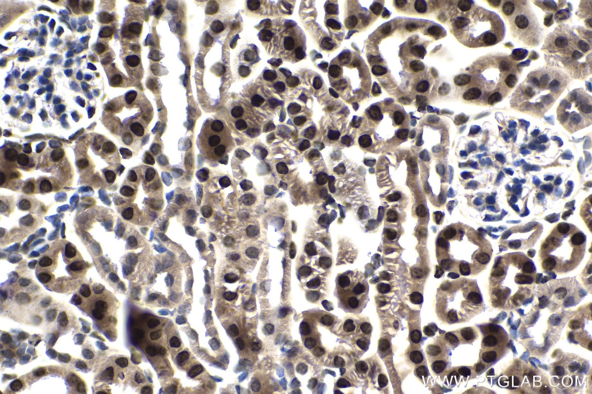 Immunohistochemistry (IHC) staining of mouse kidney tissue using ELP2 Polyclonal antibody (13793-1-AP)